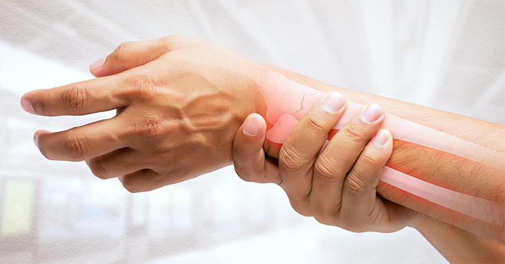 Living with Rheumatoid Arthritis