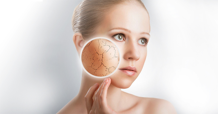 4 Simple Steps to Prevent Dry Skin - CAN